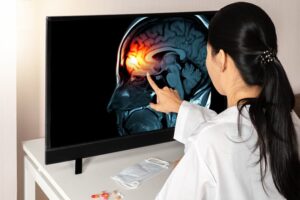 ​What Are the Long-term Effects of a Brain Injury