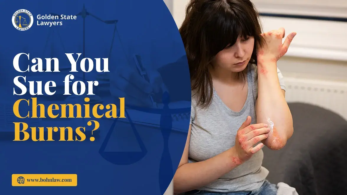 Can You Sue for Chemical Burns?